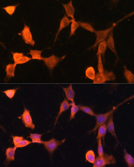 Immunofluorescence analysis of NIH-3T3 cells using CACYBP Polyclonal Antibody at dilution of  1:100. Blue: DAPI for nuclear staining.