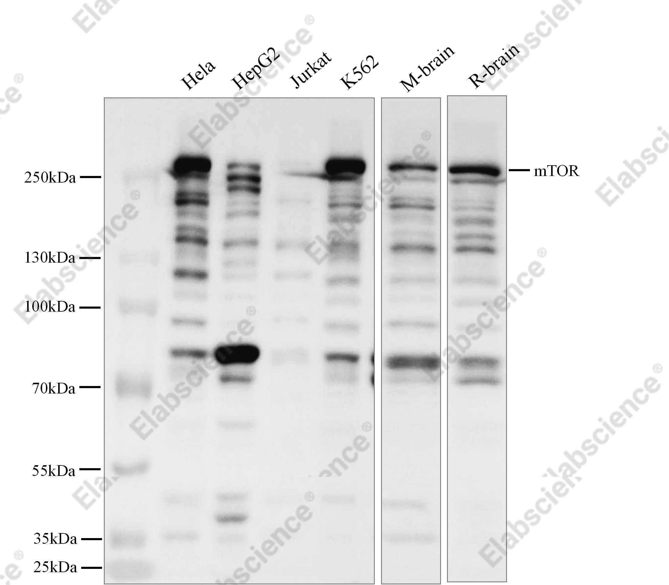 Recombinant mTOR Monoclonal Antibody - 1