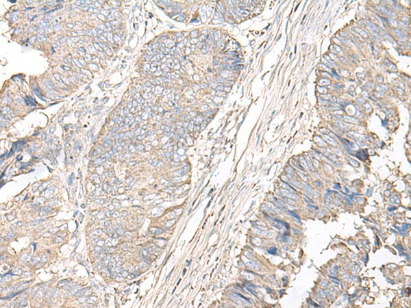 IGHA1 Polyclonal Antibody - small - 2