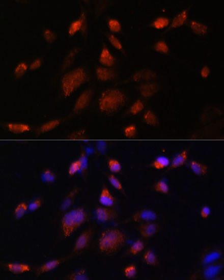 Immunofluorescence analysis of NIH-3T3 cells using TMED10 Polyclonal Antibody at dilution of 1:100. Blue: DAPI for nuclear staining.