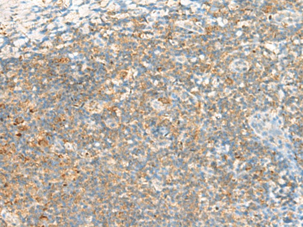 Immunohistochemistry of paraffin-embedded Human tonsil tissue  using TTLL1 Polyclonal Antibody at dilution of 1:60(?200)