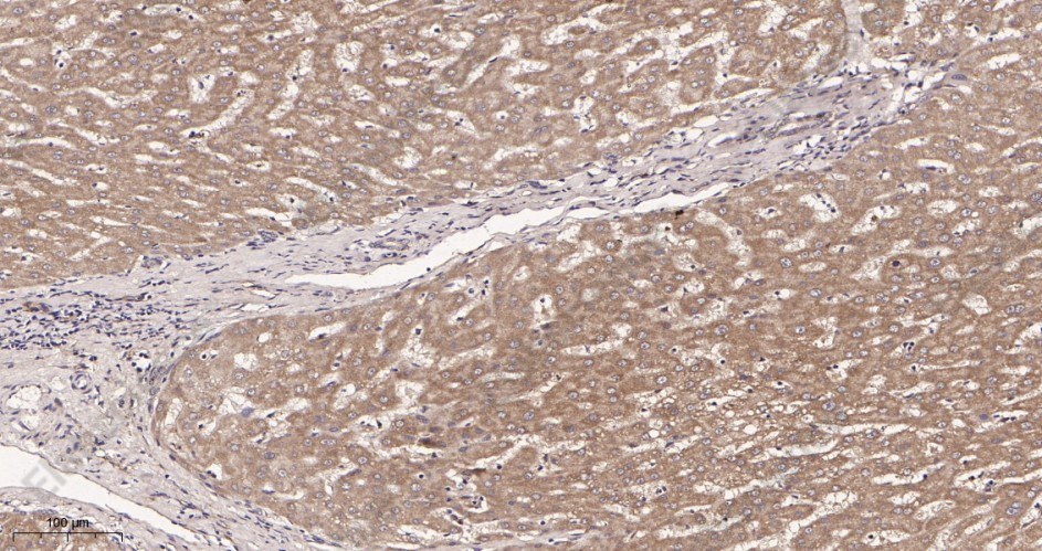Recombinant Neuropilin 1 Monoclonal Antibody - 2