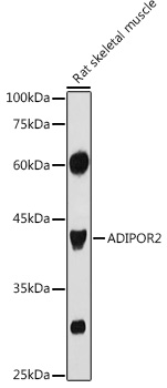 Western blot analysis of extracts of Rat skeletal muscle using ADIPOR2 Polyclonal Antibody at 1:1000 dilution.