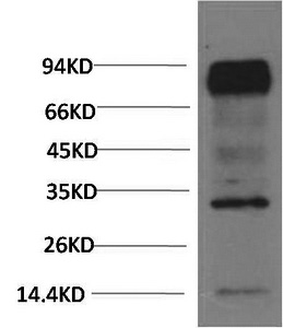 Western Blot analysis of Mouse brain using HIF1 bata Monoclonal Antibody at dilution of 1:2000.