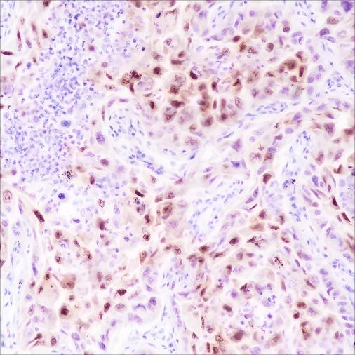 Recombinant CDKN2A/p14ARF Monoclonal Antibody - 2