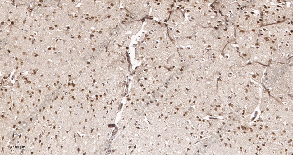 Recombinant TBR1 Monoclonal Antibody - 3