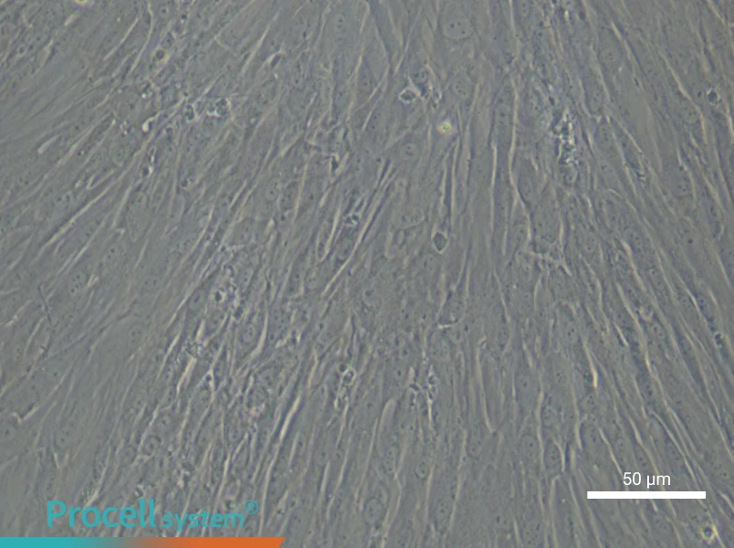 Human Keloid Fibroblast Complete Medium - small - 6