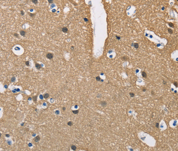 PPP3CA Polyclonal Antibody - 3
