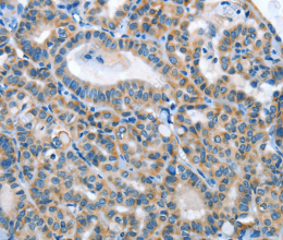ANGPT2 Polyclonal Antibody - 3