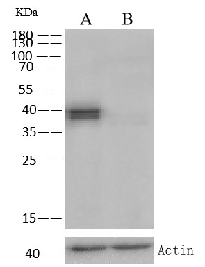 KRT19 Monoclonal Antibody - small - 4