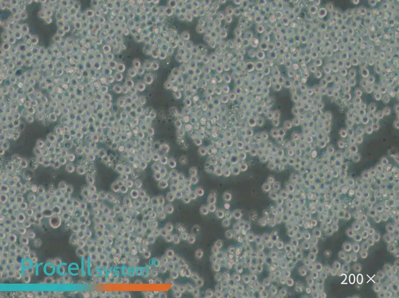 P3/NSI/1-Ag4-1 [NS-1] Cell Complete Medium - small - 6
