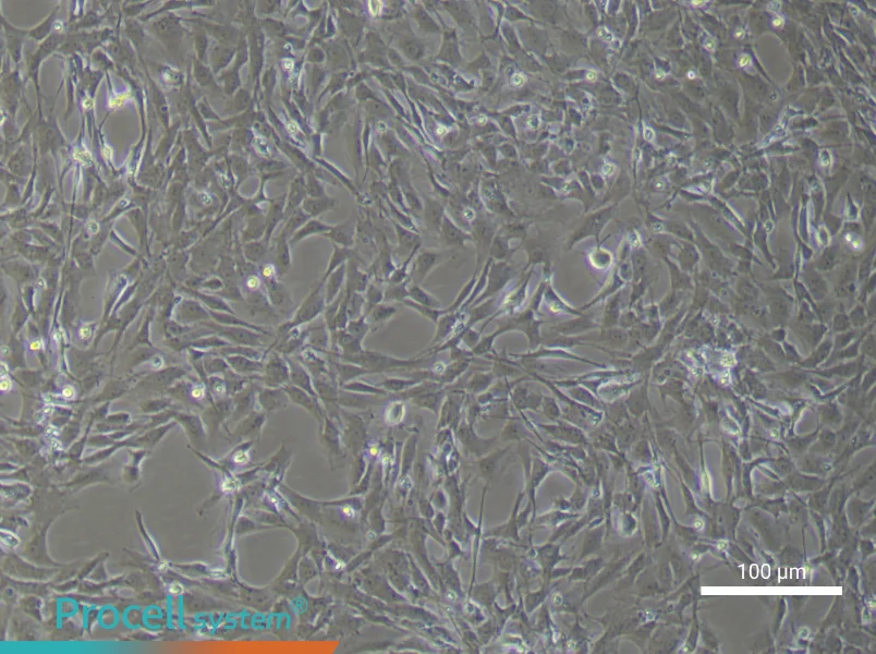 Rat Pulmonary Artery Smooth Muscle Cell Complete Medium - 1