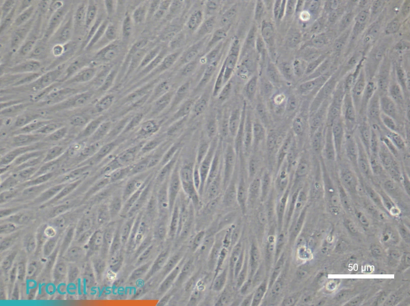 Human Choroidal Microvascular Endothelial Cell Complete Medium - 6