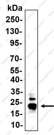 Recombinant SFRS3 Monoclonal Antibody - 1