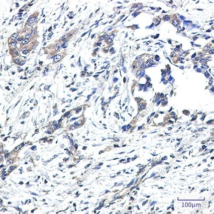 Recombinant GNAI2 Monoclonal Antibody - 3