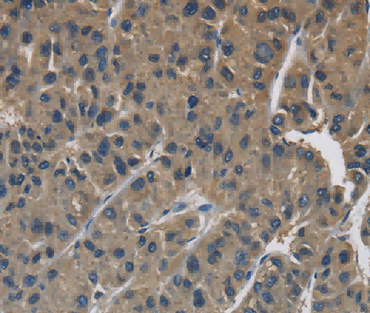 SIGMAR1 Polyclonal Antibody - 3