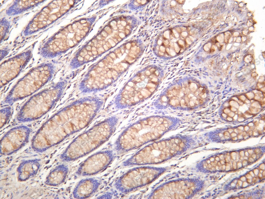 Recombinant NF-κB p65 Monoclonal Antibody - 4