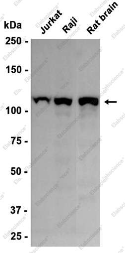 Recombinant PI3-Kinase p110 delta Monoclonal Antibody - 1