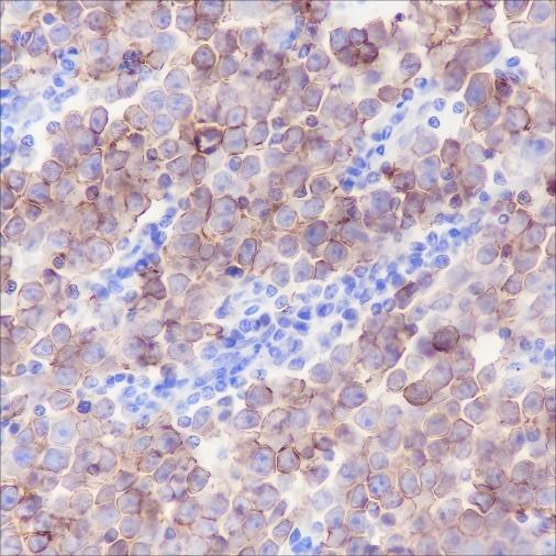 Recombinant c-Kit Monoclonal Antibody-searchlist-1