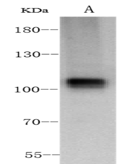 Recombinant ACE2 Monoclonal Antibody