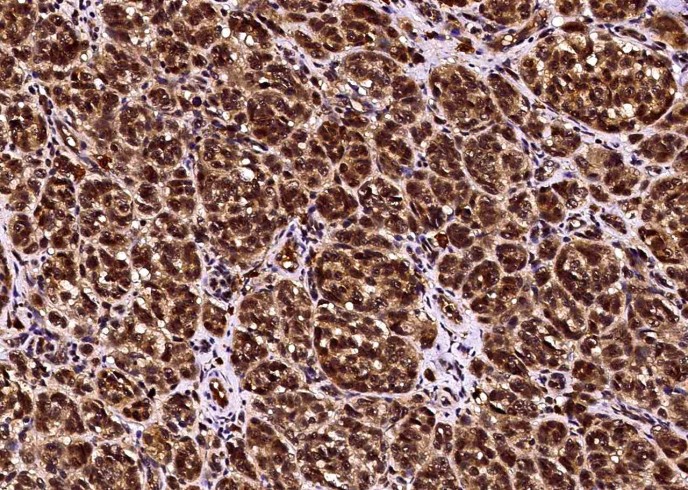 Recombinant c-Kit/CD117 Monoclonal Antibody - small - 2