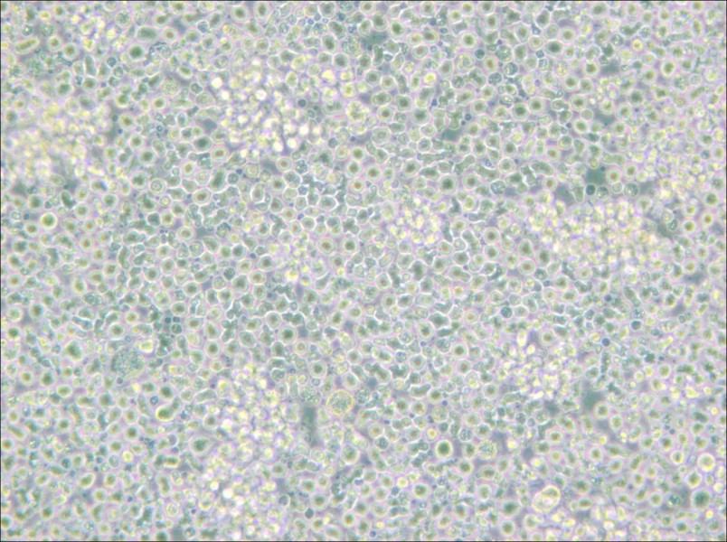 H9 [derivative of HuT 78] Cell Complete Medium - 6