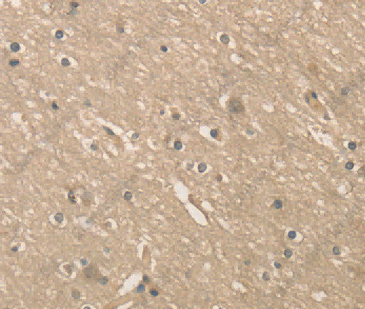 ALDH8A1 Polyclonal Antibody - 3