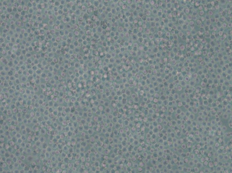 skm-1 Cell Complete Medium - 5