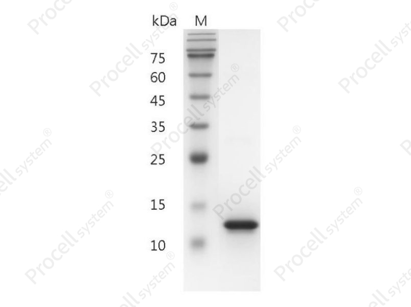 CD40L/TNFSF5/TRAP/CD154, Human, Recombinant