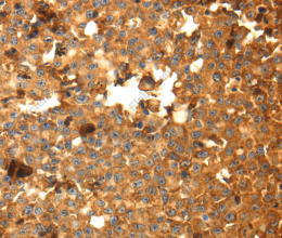 DRD5 Polyclonal Antibody - 2
