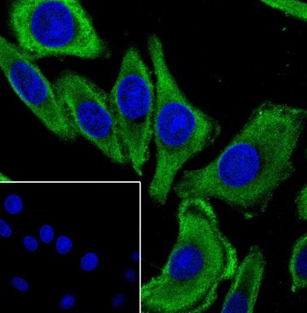 Recombinant MUC13 Monoclonal Antibody - 3
