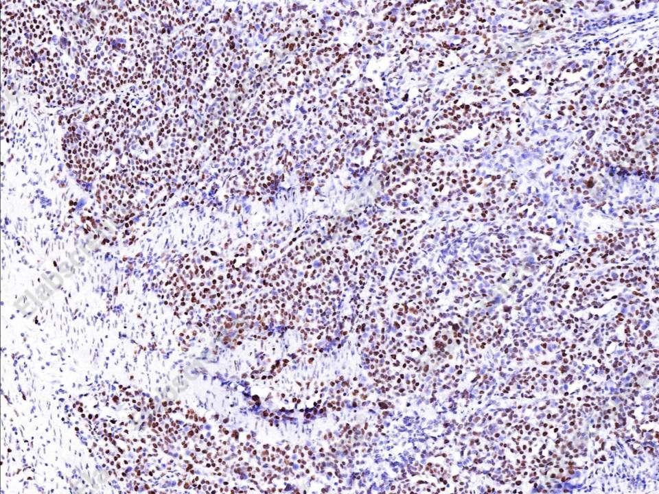 Recombinant MSH6/GTBP Monoclonal Antibody - 1