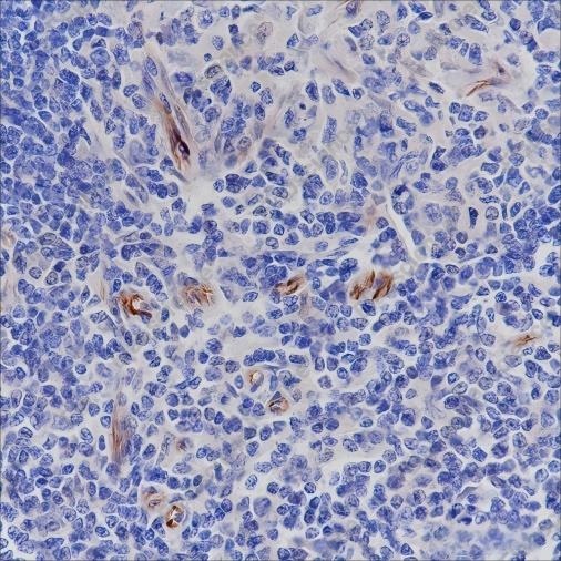 Recombinant Nestin Monoclonal Antibody - 4