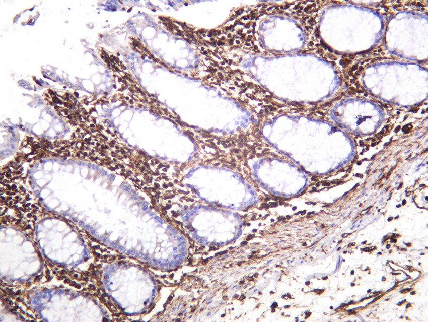 Recombinant Vimentin Monoclonal Antibody - 3
