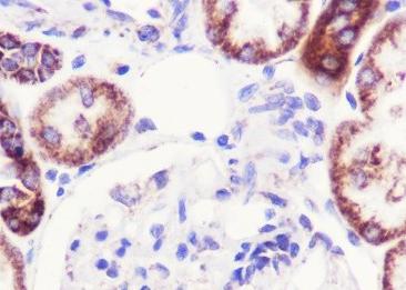 Recombinant UQCRFS1/RISP Monoclonal Antibody-searchlist-2
