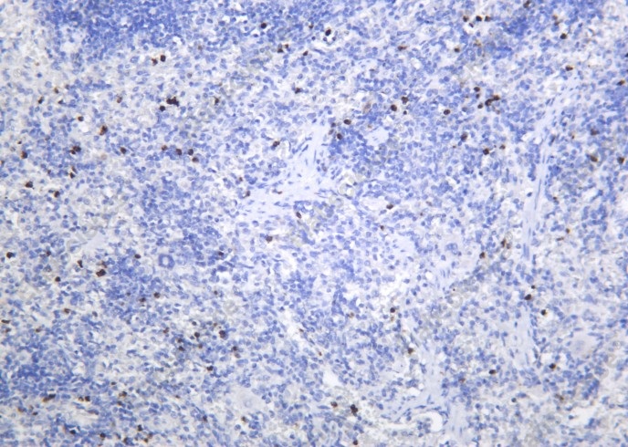 Recombinant SREBP-1 Monoclonal Antibody - 2