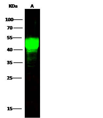 Recombinant ASGPR1 Monoclonal Antibody - small - 2