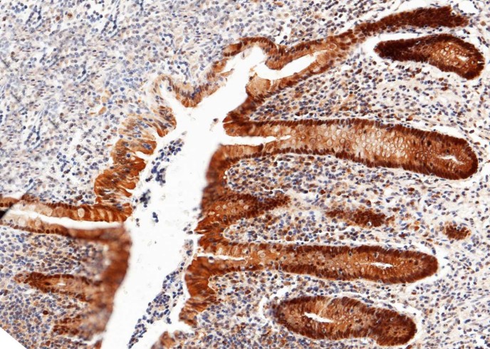 Recombinant Thioredoxin/TXN Monoclonal Antibody - 2