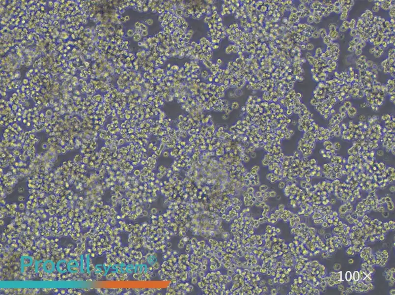 HuT 78 Cell Complete Medium - 1