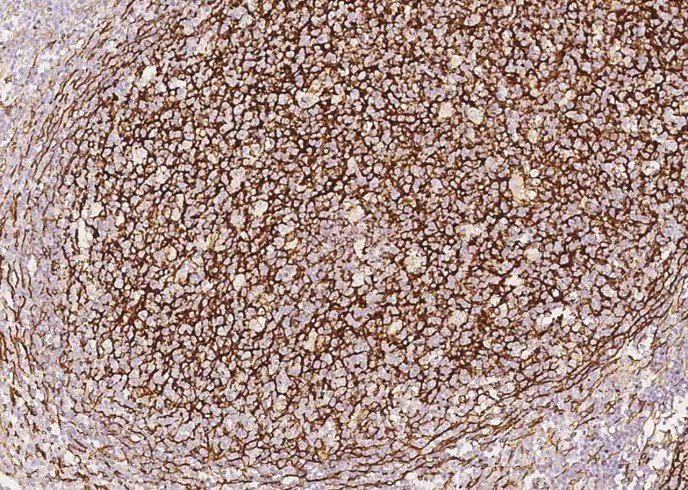 VCAM1/VCAM-1/CD106 Monoclonal Antibody-searchlist-1