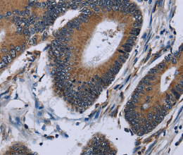 IPO4 Polyclonal Antibody - 2
