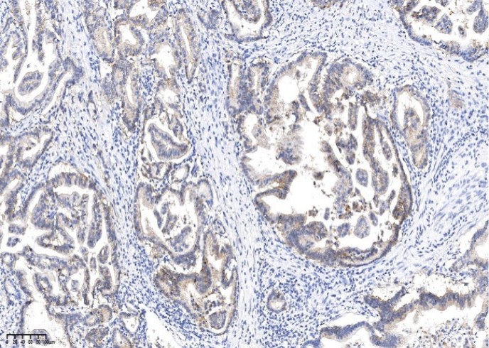 Claudin18.2 Monoclonal Antibody - 3