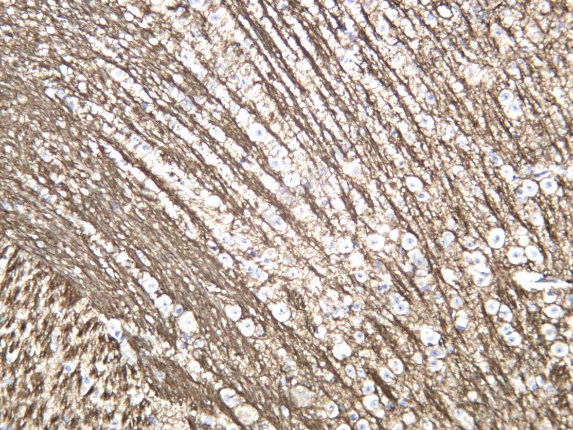 Recombinant Internexin α Monoclonal Antibody - 3
