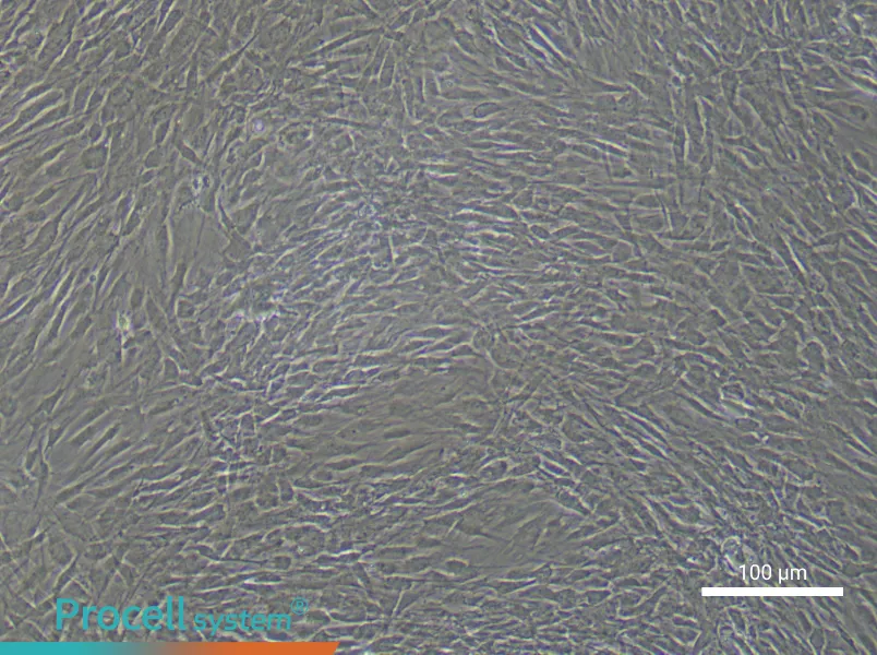 Human Uterine Smooth Muscle Cell Complete Medium - 1