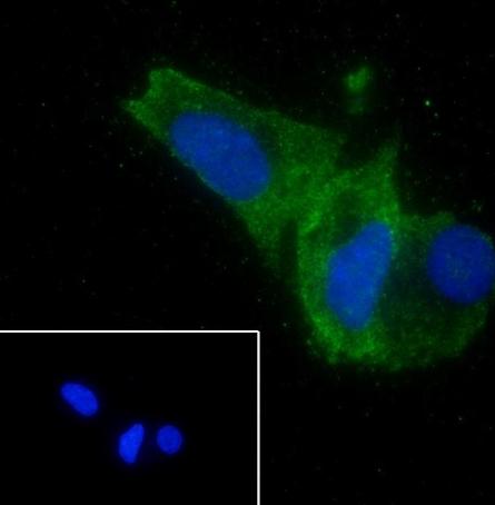 Recombinant ATG4B Monoclonal Antibody-searchlist-2