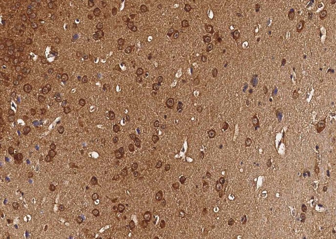 Recombinant CaM Kinase 4/CaMKIV Monoclonal Antibody - small - 2
