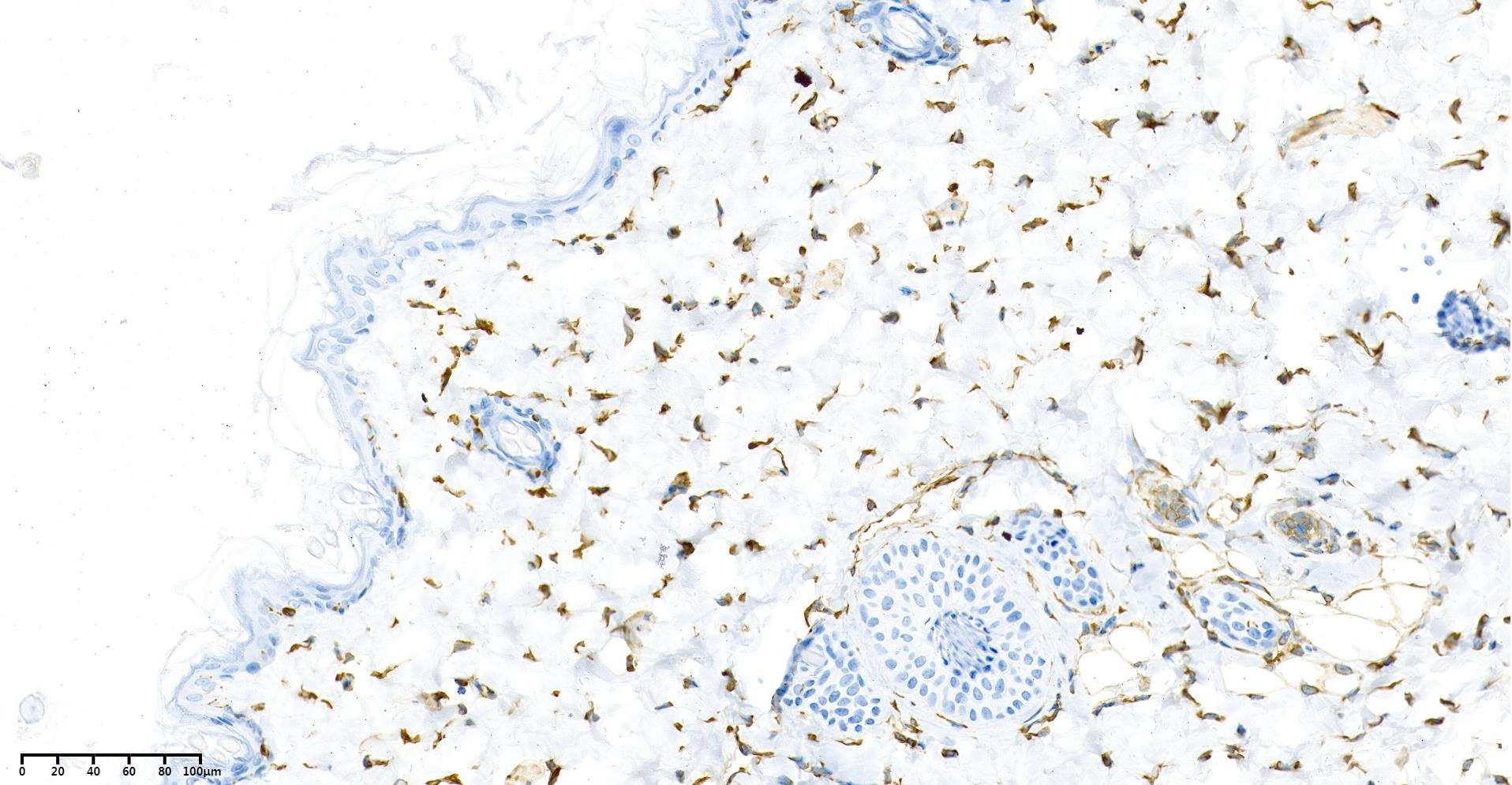 Recombinant Vimentin Monoclonal Antibody - small - 6