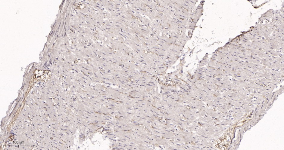 Recombinant Cyclin E1 Monoclonal Antibody - small - 3
