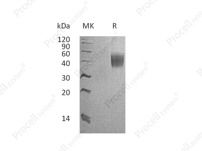 IL-4Ra (C-6His), Cynomolgus, Recombinant