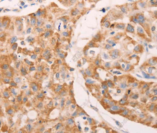 GNA11 Polyclonal Antibody - 3